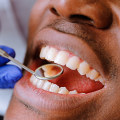 5 Tips for Achieving Optimal Oral Hygiene in Ellisville, Mississippi
