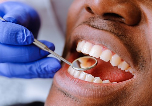 5 Tips for Achieving Optimal Oral Hygiene in Ellisville, Mississippi